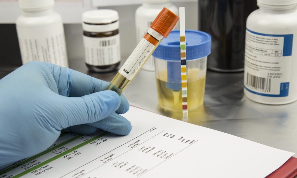 Urine drug test cup and test strip at MediCert Pro Lab